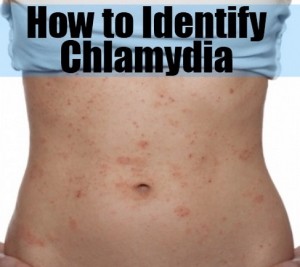 How-To-Identify-Chlamydia